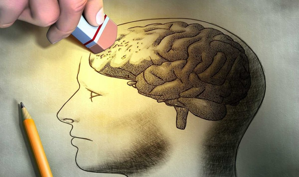 Alzheimeri tõve korral tekivad peaajus iseloomulikud koelised muutused. (Foto: Shutterstock)