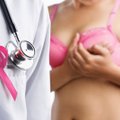 Šveitsi meditsiinikomisjoni uuring: mammograafia kasutamine rinnavähi sõeluuringutel põhjustab rohkem kahju kui kasu