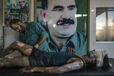 Mauricio Lima, Brasiilia, Pildistatud New York Timesile, Kurdi haiglas ravitakse Islamiriigi võitlejat.