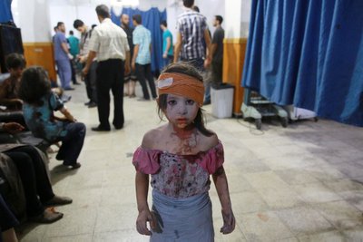 Haavatud Süüria tüdruk Douma ajutises haiglas. Pildistatud 22. augustil 2015.