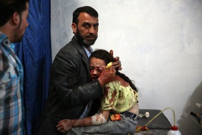 Haavatud Süüria tüdruk hoiab sugulasest kinni ja ootab arsti. Pildistatud Süürias 11. mail 2015.