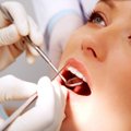 LUGEJA KÜSIB: Kas katkiste hammaste tõttu võib surra?