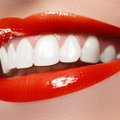 Hambaarst: need on kõige hambasõbralikumad maiustused