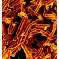 WHO: mullu on märkamata jäänud umbes kolm miljonit tuberkuloosijuhtu