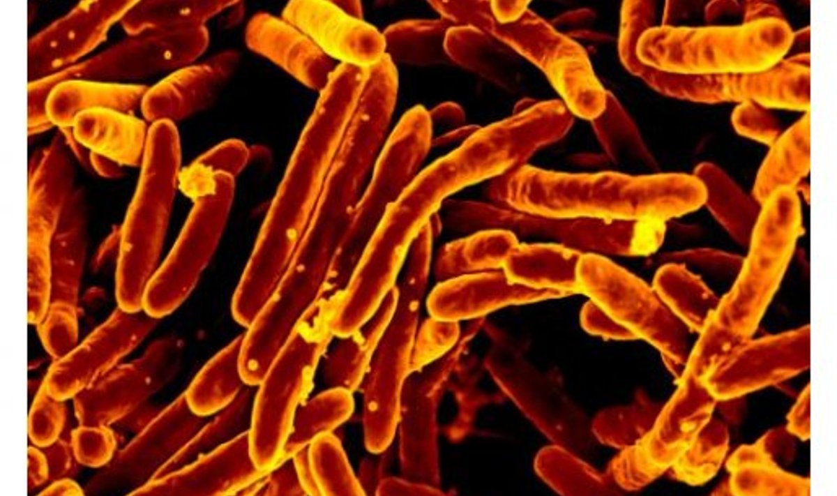 Mycobacterium tuberculosis. Foto: infectionlandscapes.org