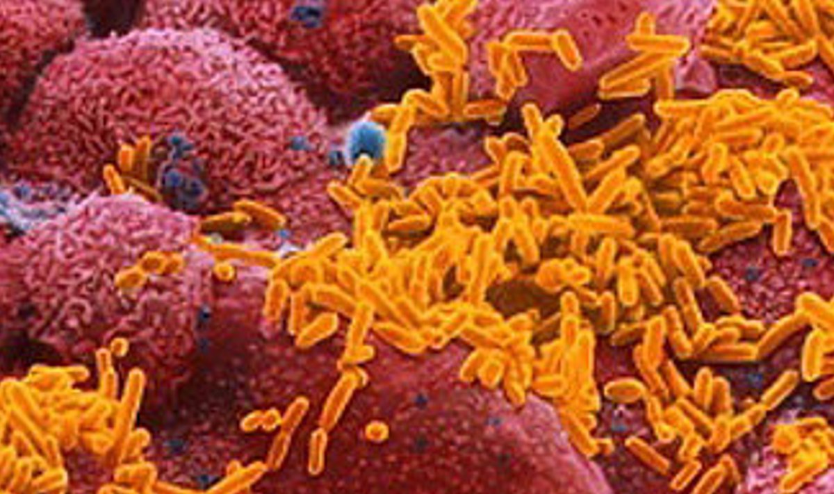 Haemophilus influenzae bakterid mikroskoobi all. https://www.nhs.uk/