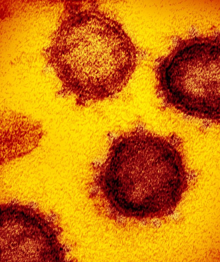 MUTEERUB, ET ELADA: Viirus muutub iga paljunemisega, algset nn Wuhani varianti on maailmast juba isegi raske leida. Mutatsioonid võivad aga tähendada suuremat nakkamist, haigestumist, surmi.