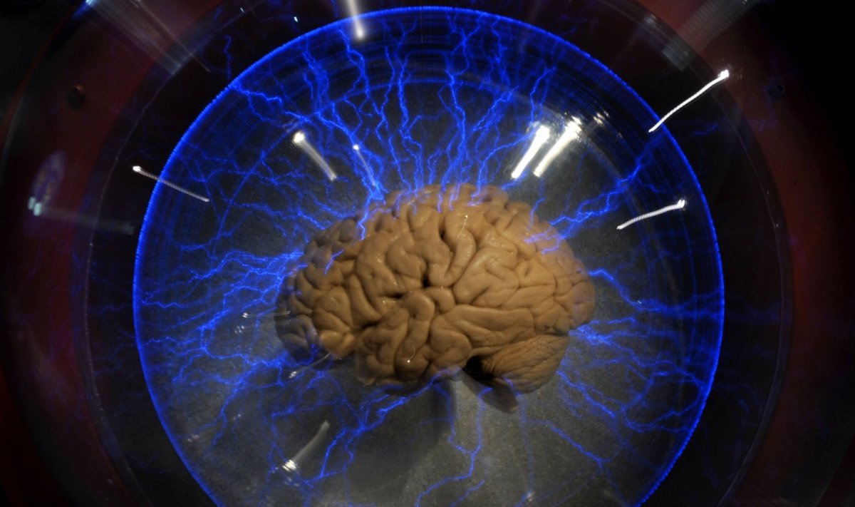 Illustreerival eesmärgil: ehtne inimaju klaaskastis, ajuteemalisel näitusel Brasiilias. (Foto: AFP)