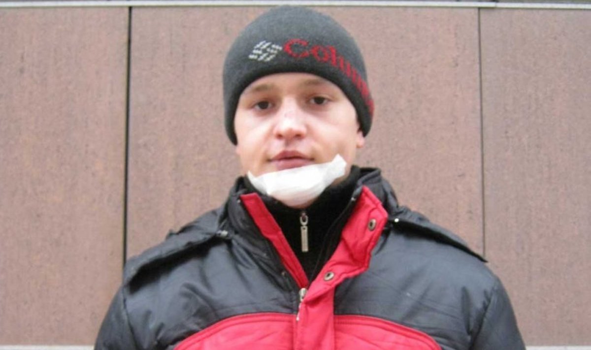 Noormees täna: Ligemale kuu aega tagasi peksti Juri segastel asjaoludel vaeseomaks. (Foto: gazeta.ua)