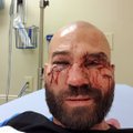FOTOD | UFC-st kinga saanud võitlejad tagusid teineteist paljaste rusikatega veriseks. McGregor kiitis venelasest sõpra