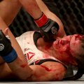Karm tõde: MMA-tähed lasevad end tümitada kõigest sandikopikate eest