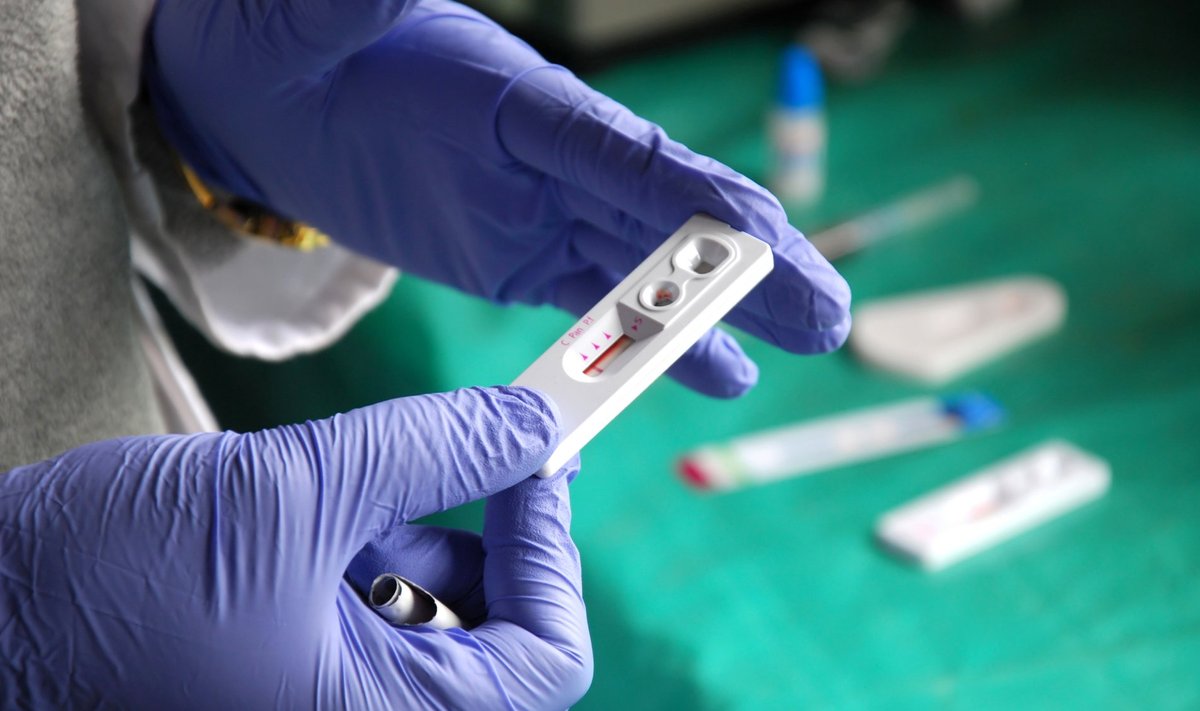 MTÜ Perearstide Selts on haigekassale esitanud taotluse, et HIV kiiranalüüsid lisataks tervishoiuteenuste loetellu.