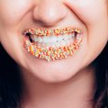 Hambaarst soovitab: järgi päeva jooksul neid reegleid ja su hambad on tervemad