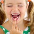 Ранняя потеря молочных зубов может вызвать проблемы в развитии детей