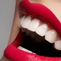 7 ootamatut viisi, kuidas ise oma hammastele igapäevaselt plekke tekitad