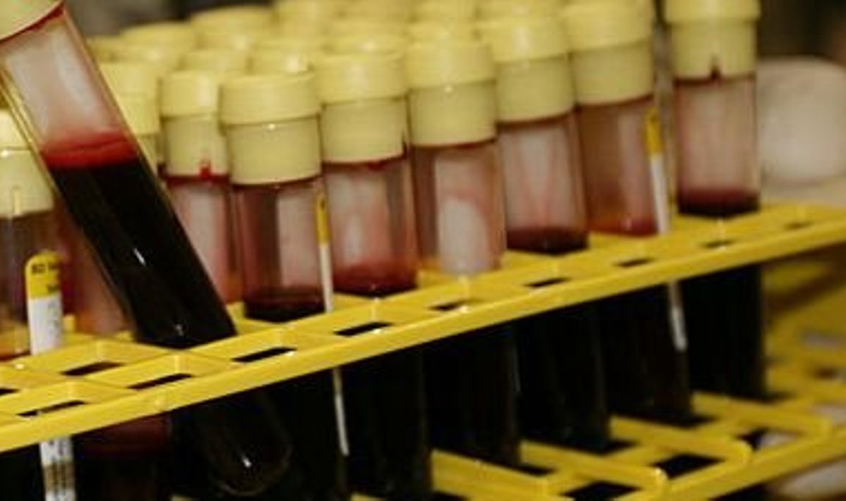 Sünteetiline veri võiks tulevikus lahendada mitmeid doonorverega seonduvaid probleeme. 