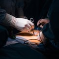 За месяц более 7000 жителей Эстонии разрешили использовать свои органы для пересадки