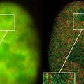 Nobeli keemiapreemia läks optilise nanoskoopia pioneeridele