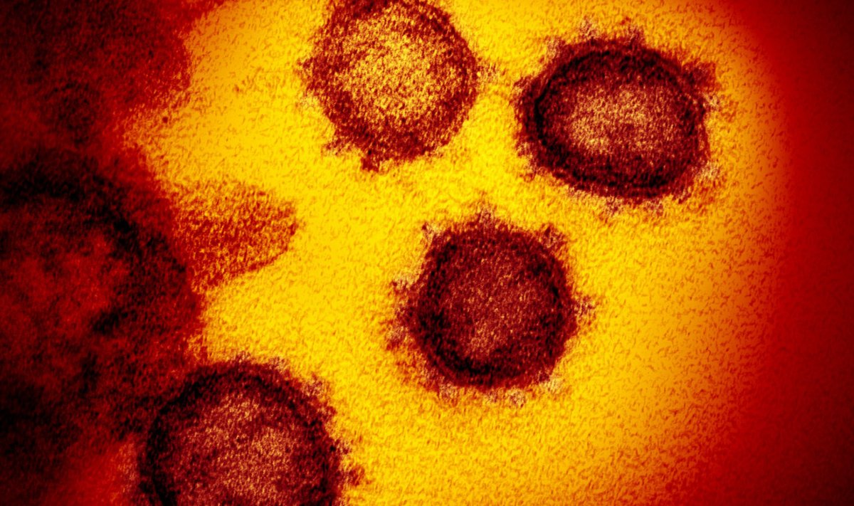 Koroonaviirus SARS-CoV-2 elektronmikroskoobi all. (Foto: NIAID-RML / (CC BY 2.0))