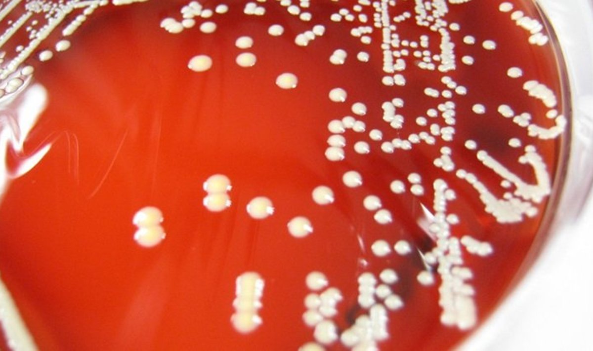 Staphylococcus lugdunensis ehk bakter, mis suudab toota antibiootikumi. (Foto: mostly*harmless/Creative Commons)