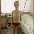 Tuntud Venemaa iluuisutreenerit süüdistatakse anoreksia põhjustamises - õpilane kaalus 24 kilo