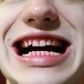 Jaanika Lauk: kui hambaarst ei taha haigekassa lepingut, ärgu imestagu, kui kliendid lahkuvad