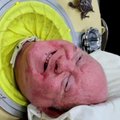 Ameerikas suri 78-aastaselt „rauast kopsuga mees“ ehk Polio-Paul- kes ta oli?