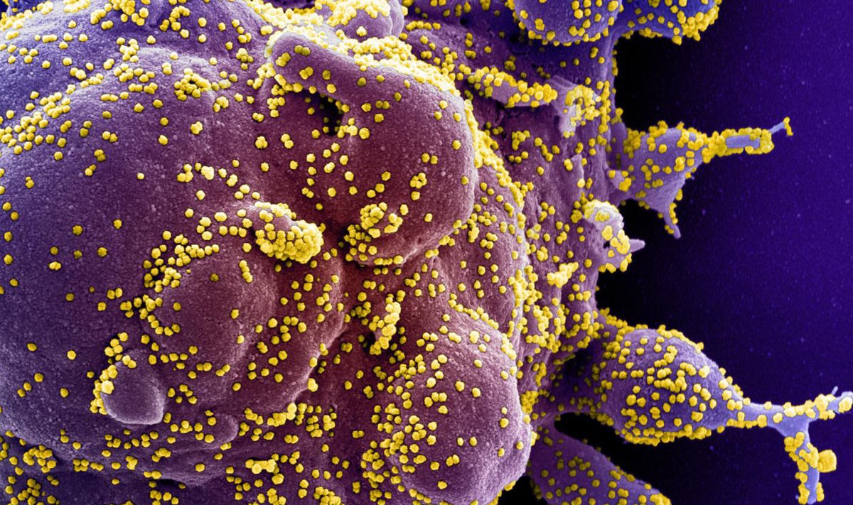 Цветная фотография мертвой клетки, пораженной вирусом SARS-COV-2