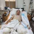 „Ma vaatasin lae kohalt, kuidas arstid annavad mulle ühe elektrilöögi teise järel.“ Ukraina sõdur tegi läbi kolm kliinilist surma