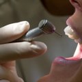 Lõpp karjetele hambaarstitoolil? Uudne auke täiskasvatav materjal võib peagi turul olla