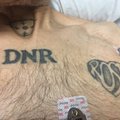 Правда ли, что в Европе отказались реанимировать гражданина России с татуировкой DNR 2014?