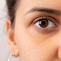 Silmaalused turses ja tumedad? Üks lihtne nipp aitab silmaaluseid kiiresti turgutada