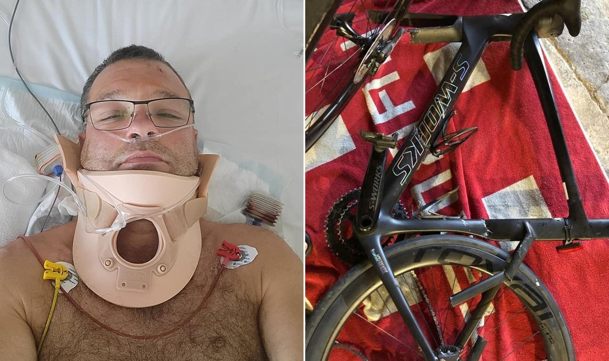 Vasakul ettevõtja Rain Tulp haiglas ja paremal foto tema rattast pärast õnnetust