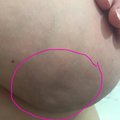 Julge naise postitus Facebookis: hoiatav foto imeväikesest märgist, mis võib rinnavähile viidata