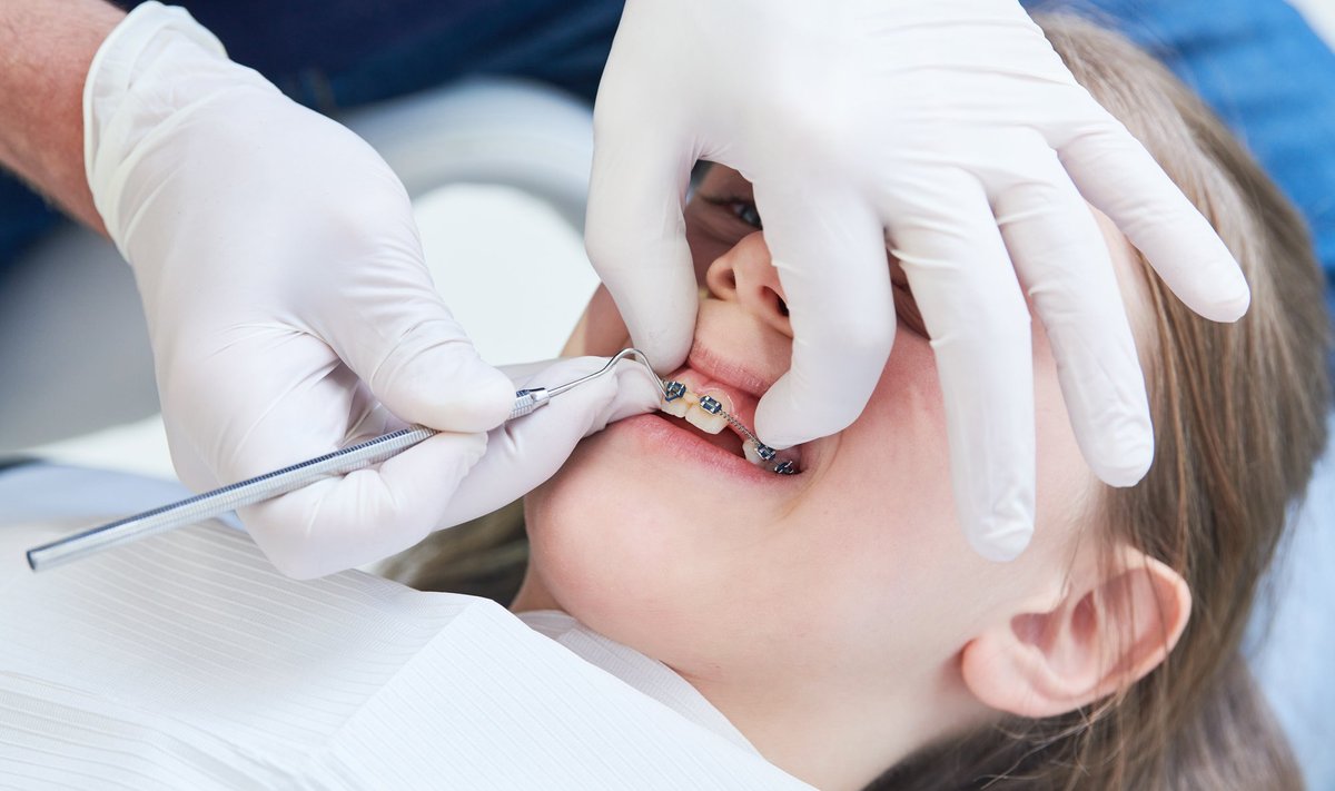 Ortodont võiks vajadusel üle vaadata umbes kaheksa-aastase lapse hambumuse .