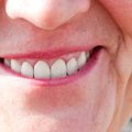 Mees kulutas oma säästud uue kallima hammaste peale, aga naine kadus, kui hambad suhu sai