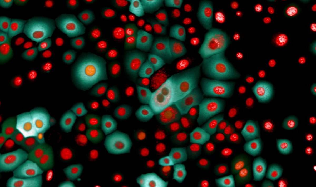 Elusad inimese piimanäärme epiteelrakud, milles on sinise ja rohelisega värvitud erinevaid valke ja punasega raku tuumasid. Pilt saadi Operetta CLS-i konfokaal-režiimis. (Foto: Dr. Somponnat, Mahidoli ülikool)