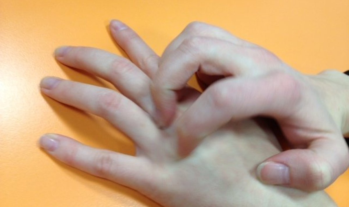 Sügelev lööve on märgatav sõrmede vahel