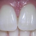 Hambad võivad ise paraneda – elektrivoolu abil (ärge siiski kodus katsetage!)