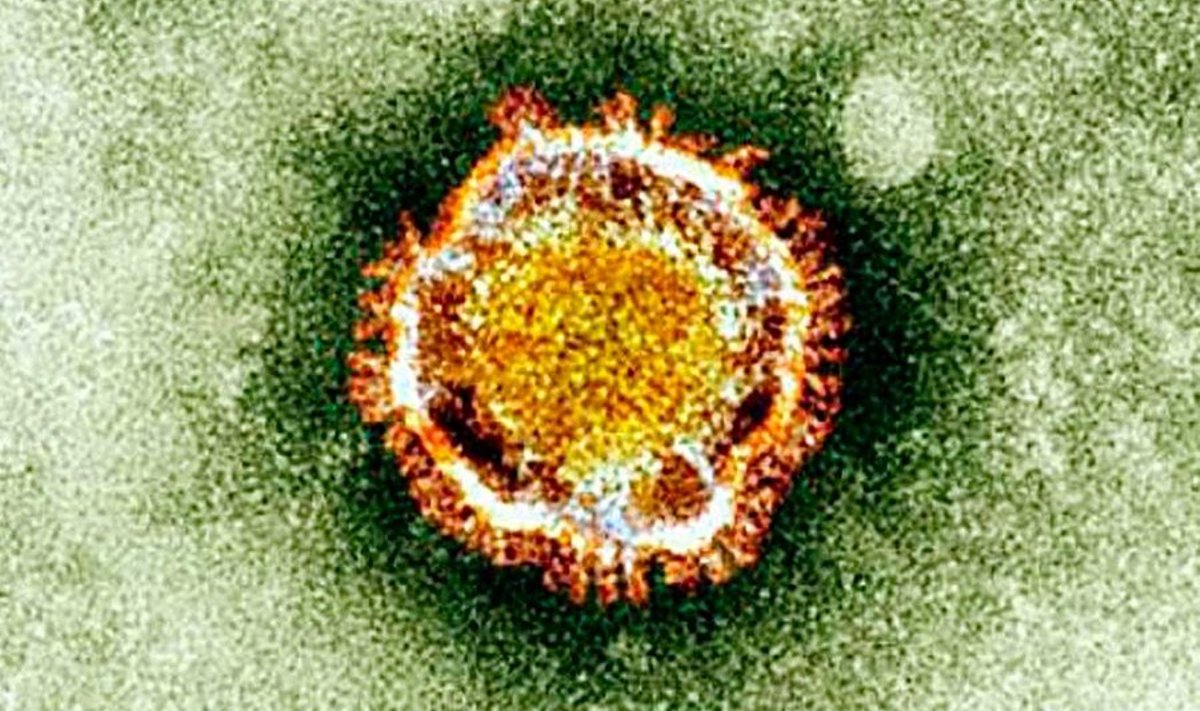 Tõsisem kui gripp: Tervishoiuameti epidemioloogianõunik Kuulo Kutsar lausub, et MERS-CoV viirus on ohtlikum kui gripiviirus, kuid nakkab raskemini. Ka on sel pikem peiteaeg, ulatudes 9–12 päevani.