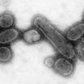 Журнал "Дипломатия": Испанский грипп — печально известная пандемия XX века