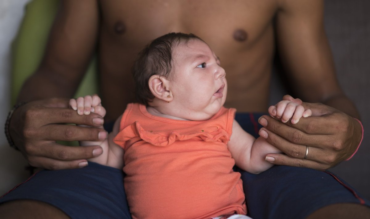 Möödunud aasta oktoobris sündinud Luizal on mikrokefaalia. Tema ema oli saanud sääsehammustusest Zika viiruse. Oktoobrist alates on Brasiilia arstid loendanud juba 3893 mikrokefaalia juhtumit.