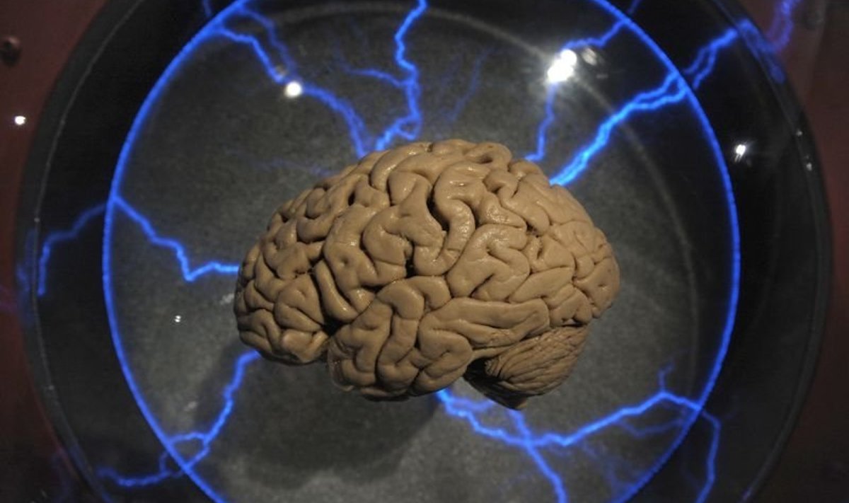An actual human brain displayed inside a glass box, as part of an interactive exhbition "Brain: a world inside your head", in Sao Paulo, Brazil, on August 21, 2009. The exhibition, which presents on interactive installations how functions and physiology of the brain are developed since childhood until old age, runs until 25 October. AFP PHOTO/Mauricio LIMA