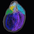 LIIKUV PILT | See on esimene ruumiline kaart südame "ajust"