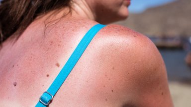 HEA TEADA | Mis peitub lühendite UV ja SPF taga ning kuidas end päikese ohtliku mõju eest kaitsta?