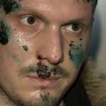 В Киеве тяжело ранен обвинямый в подготовке покушения на Путина