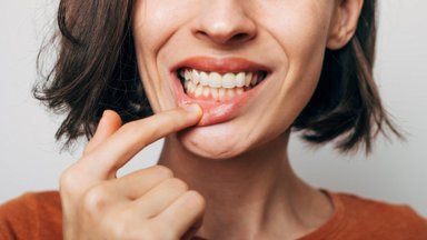 Что делать, если болят десны: стоматолог поделилась ценными советами