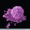 Vähkkasvaja avastamiseks piisab tulevikus vaid vereproovist