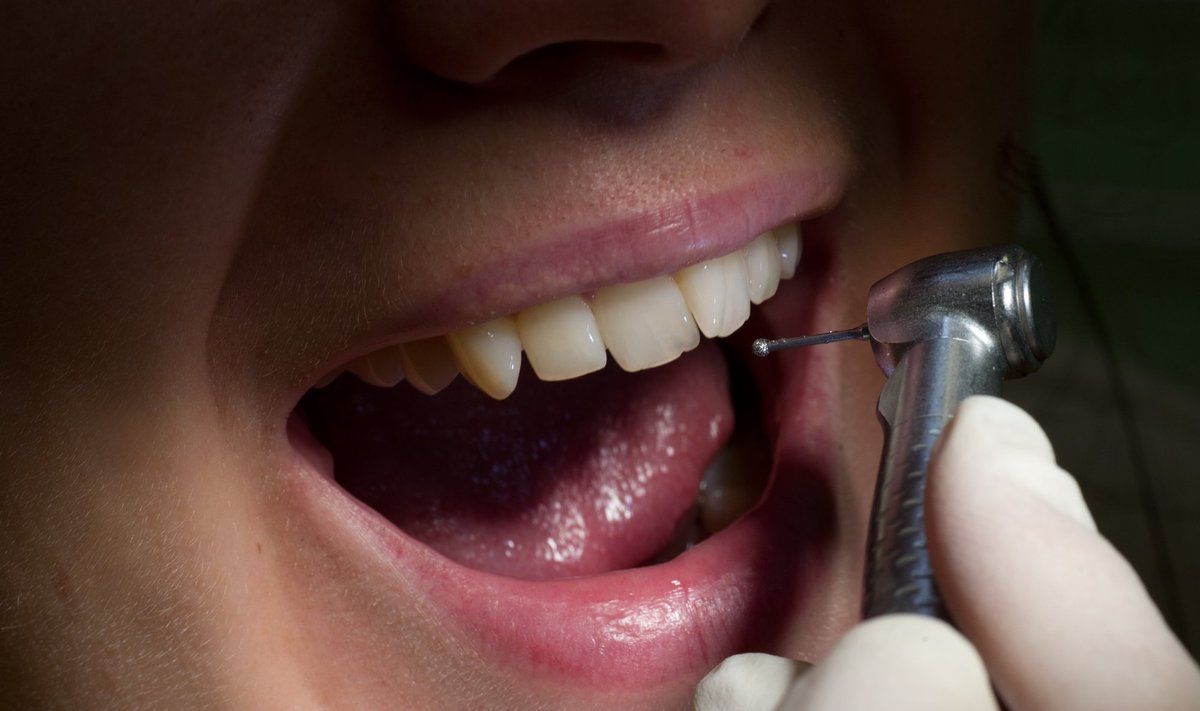 Laste hambaravi on küll tasuta, ent paljusid lapsi hambaarsti juurde ei viida.