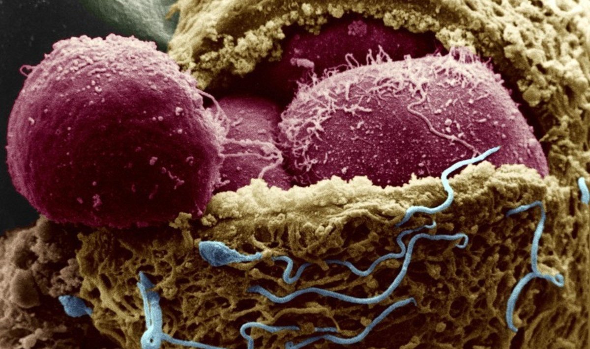 Nelja päeva vanune inimembrüo. Munaraku kest on avatud, selle seest paistavad embrüorakud, munaraku pinnal on näha ka spermatosoide
